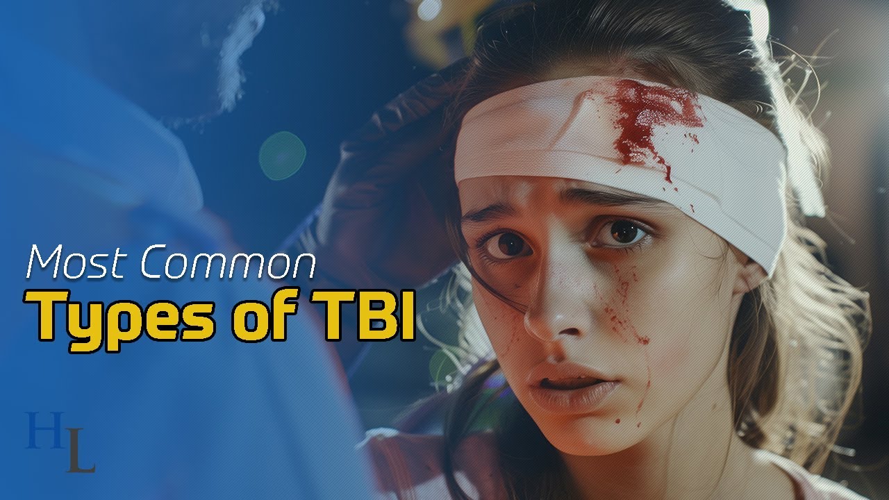 tbi-types-from-car-accidents